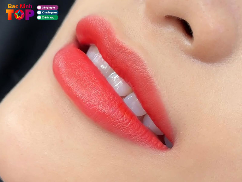 Tham-my-vien-kang-bac-ninh-bacninhtoplist