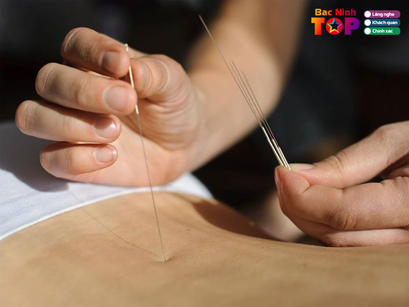 Tieu-chi-lua-chon-dia-chi-cham-cuu-tai-bac-ninh-uy-tin-1-bacninhtoplist