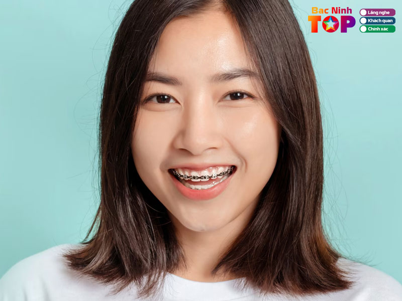 Tieu-chi-lua-chon-nha-khoa-nieng-rang-tai-bac-ninh-chat-luong-bacninhtoplist