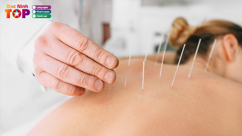 Top-6-dia-chi-cham-cuu-tai-bac-ninh-giup-giam-dau-hieu-qua-bacninhtoplist