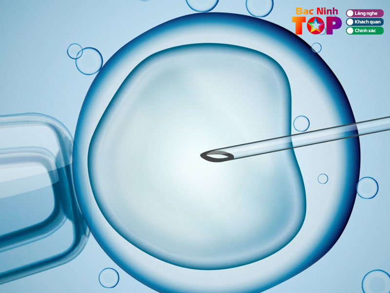 Cau-hoi-thuong-gap-ve-dich-vu-lam-ivf-tai-bac-ninh-bacninhtoplist-3