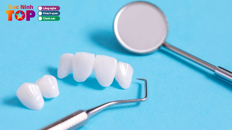 Trong-rang-su-co-may-loai-cach-lua-chon-phu-hop-theo-tu-van-nha-khoa-bacninhtoplist