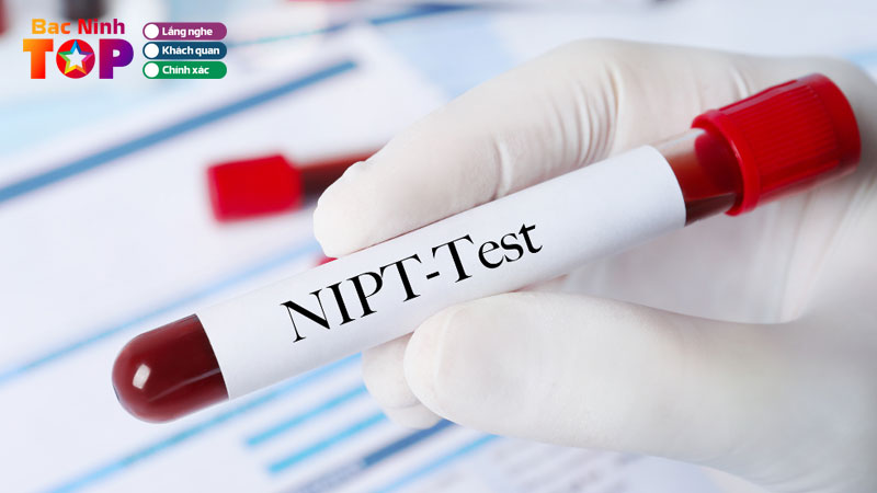Top-5-dia-diem-xet-nghiem-nipt-tai-bac-ninh-duoc-tin-tuong-bacninhtoplist