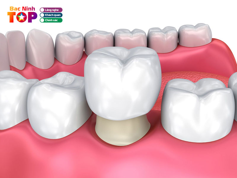 Nha-khoa-quoc-te-tue-minh-chi-nhanh-bac-ninh-1-bacninhtoplist