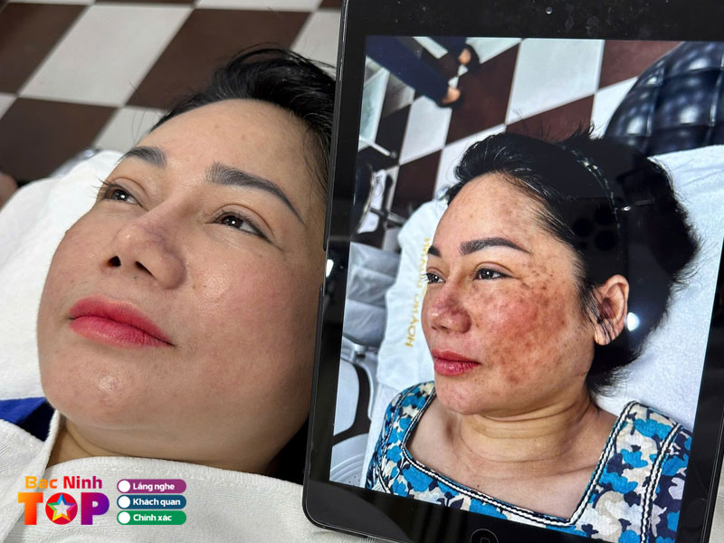 Vien-tham-my-hoang-doanh-bacninhtoplist