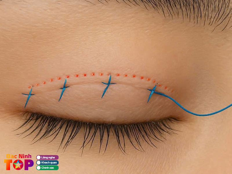 Thu-cuc-clinics-bacninhtoplist