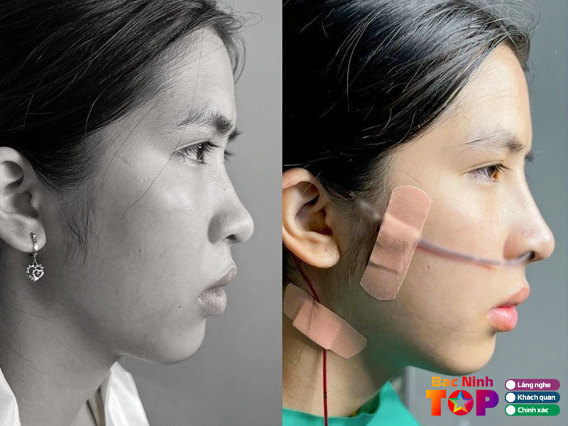 Thu-cuc-clinics-bacninhtoplist